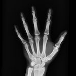 Breaking Down the Costs of ED Treatments and Their Effectiveness