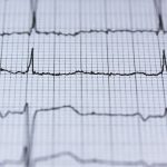 The Role of Counseling in Successful Erectile Dysfunction Treatment