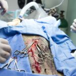 The Importance of Consulting a Specialist in Erectile Dysfunction Treatments