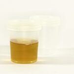 Innovative Treatments: Exploring the Latest Advances in ED Solutions