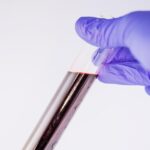 The Impact of Nutrition on Successful ED Treatment